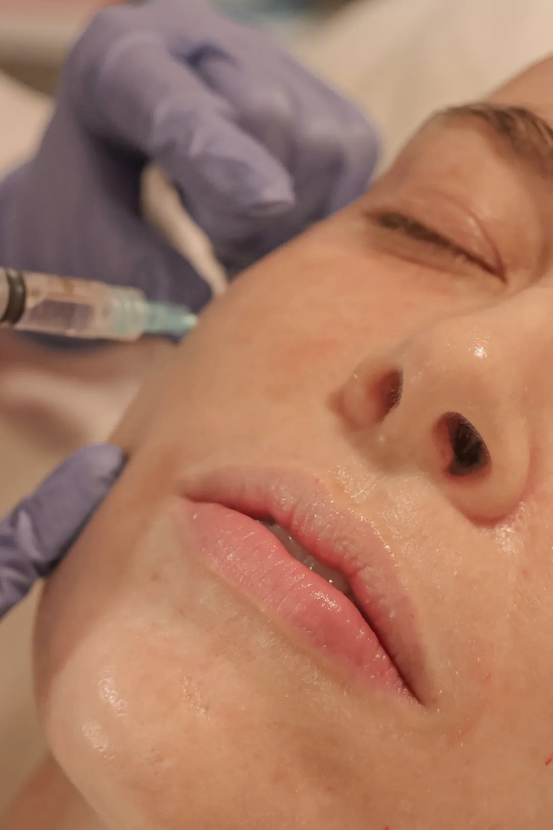 Imagen del tratamiento